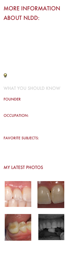 MORE INFORMATION ABOUT NLDD:

 OUR MISSION STATEMENT
 ARTICLES
 REFERENCES
 FOR PATIENTS
 FOR DENTISTS
 ABUTMENTS
 TESTIMONIALS

What you should know

Founder
Gordon Russell BSc, RDT   

Occupation:
Owner & Registered Dental Technologist

Favorite Subjects:
Family, Teeth, Photography, Excellence


My Latest Photos

￼￼￼￼